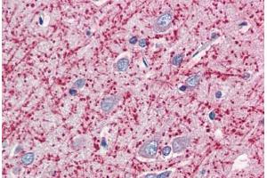 Human Brain, Cortex (formalin-fixed, paraffin-embedded) stained with MOG antibody ABIN337146 at 5 ug/ml followed by biotinylated anti-goat IgG secondary antibody ABIN481715, alkaline phosphatase-streptavidin and chromogen. (MOG anticorps  (AA 248-259))