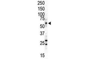 Western blot analysis of MAPK8/ JNK1 antibody and HL-60 (UV-treated) cell lysate.