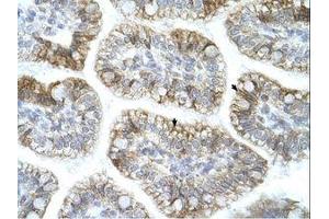 Image no. 1 for anti-Amyloid beta (A4) Precursor Protein-Binding, Family A, Member 1 (APBA1) (AA 41-90) antibody (ABIN6736687)