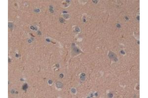 Detection of CYLD in Human Brain Tissue using Polyclonal Antibody to Cylindromatosis (CYLD) (CYLD anticorps  (AA 170-338))