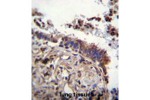 TTBK2 Antibody (N-term) immunohistochemistry analysis in formalin fixed and paraffin embedded human lung tissue followed by peroxidase conjugation of the secondary antibody and DAB staining. (TTBK2 anticorps  (N-Term))