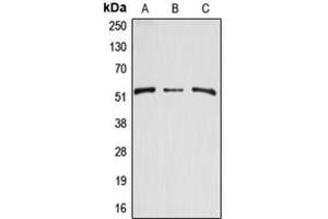 Western blot analysis of Arylsulfatase A expression in HEK293T (A), mouse kidney (B), rat kidney (C) whole cell lysates. (Arylsulfatase A anticorps  (Center))
