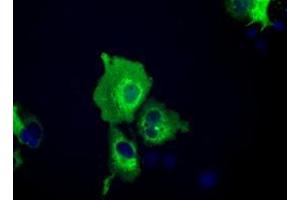 Image no. 6 for anti-Insulin-Like Growth Factor 2 mRNA Binding Protein 2 (IGF2BP2) antibody (ABIN1498821) (IGF2BP2 anticorps)