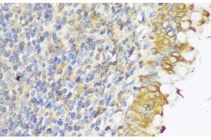 Immunohistochemistry of paraffin-embedded Human appendix using GLB1L3 Polyclonal Antibody at dilution of 1:150 (40x lens). (GLB1L3 anticorps)