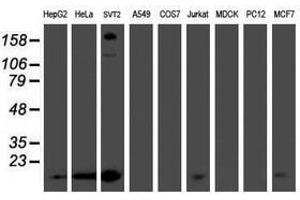 Image no. 1 for anti-Phosphomevalonate Kinase (PMVK) antibody (ABIN1500303)