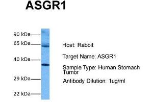Host: Rabbit Target Name: ASGR1 Sample Tissue: Human Stomach Tumor Antibody Dilution: 1. (Asialoglycoprotein Receptor 1 anticorps  (Middle Region))