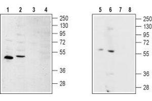 Western blot analysis of rat kidney (lanes 1 and 3), rat heart (lanes 2 and 4), human SH-SY5Y brain neuroblastoma (lanes 5 and 7) and Human MS-1  neuroendocrine skin carcinoma cell (lanes 6 and 8) lysates: - 1,2,5,6. (S1PR2 anticorps  (2nd Cytoplasmic Loop))
