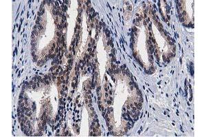 Image no. 4 for anti-Transforming, Acidic Coiled-Coil Containing Protein 3 (TACC3) antibody (ABIN1498095) (TACC3 anticorps)