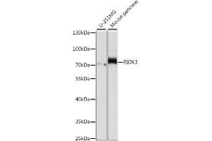 Western blot analysis of extracts of various cell lines, using RIOK3 antibody (ABIN7270112) at 1:1000 dilution.