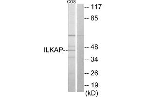 Western blot analysis of extracts from COS-7 cells, using ILKAP antibody. (ILKAP anticorps  (Internal Region))