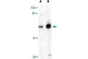 Western blot analysis of PTPN11 in mouse skeletal muscle tissue lysate with PTPN11 polyclonal antibody  at (A) 0. (PTPN11 anticorps  (N-Term))