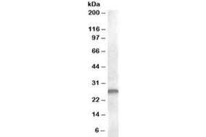 Western blot testing of human kidney lysate with CLEC1B antibody at 1ug/ml. (C-Type Lectin Domain Family 1, Member B (CLEC1B) anticorps)