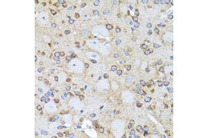 Immunohistochemistry of paraffin-embedded rat brain using ACTR2 antibody. (ACTR2 anticorps  (AA 1-160))