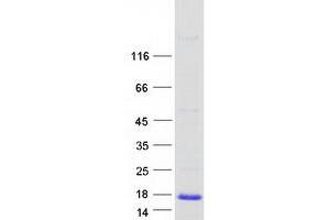 Validation with Western Blot