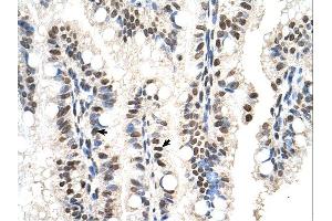 RUNDC2A antibody was used for immunohistochemistry at a concentration of 4-8 ug/ml. (SNX29 anticorps  (N-Term))