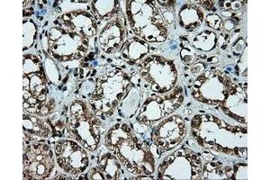 Immunohistochemical staining of paraffin-embedded liver tissue using anti-PLEK mouse monoclonal antibody. (Pleckstrin anticorps)