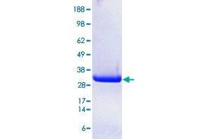 Image no. 1 for P21 Protein (Cdc42/Rac)-Activated Kinase 7 (PAK7) (AA 425-719) (Active) protein (ABIN5570021)