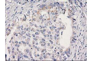 Image no. 1 for anti-Mitochondrial Ribosomal Protein S2 (MRPS2) antibody (ABIN1499562)