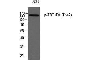 Western Blotting (WB) image for anti-TBC1 Domain Family, Member 4 (TBC1D4) (pThr642) antibody (ABIN5955761) (TBC1D4 anticorps  (pThr642))