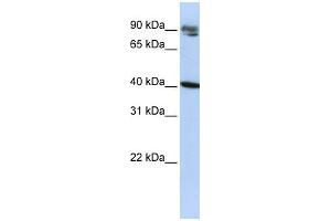 WB Suggested Anti-KLHDC8A Antibody Titration:  0. (KLHDC8A anticorps  (Middle Region))