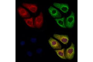 TBCE Antibody staining Hela cells by IF/ICC.