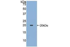 anti-Ecotin (AA 21-162) antibody