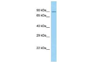 WB Suggested Anti-CAPN10 Antibody Titration: 1. (CAPN10 anticorps  (N-Term))