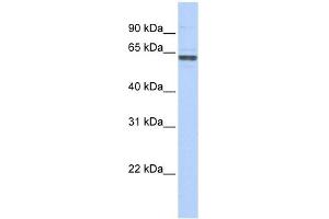 RNMT antibody used at 1 ug/ml to detect target protein. (RNMT anticorps)