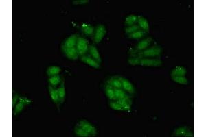 Immunofluorescent analysis of HepG2 cells using ABIN7162672 at dilution of 1:100 and Alexa Fluor 488-congugated AffiniPure Goat Anti-Rabbit IgG(H+L)
