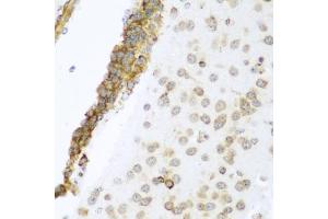 Immunohistochemistry of paraffin-embedded mouse brain using YBX1 antibody. (YBX1 anticorps)