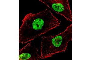 anti-B-Cell CLL/lymphoma 9 (BCL9) (AA 272-304) antibody