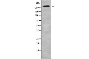 Western blot analysis NAV2 using HeLa whole cell lysates (NAV2 anticorps  (Internal Region))