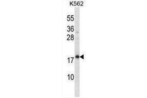 CREG1 Antibody (N-term) western blot analysis in K562 cell line lysates (35µg/lane). (CREG1 anticorps  (N-Term))