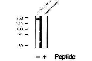 Western blot analysis of extracts of human placenta tissue, using PRPF8 antibody. (PRPF8 anticorps  (C-Term))