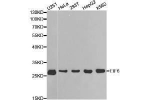 Western blot analysis of extracts of various cell lines, using EIF6 antibody. (EIF6 anticorps)