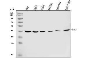 Western blot analysis of Sorbitol Dehydrogenase/SORD using anti-Sorbitol Dehydrogenase/SORD antibody (ABIN7602485).
