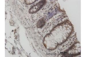 Immunoperoxidase of monoclonal antibody to GCN5L2 on formalin-fixed paraffin-embedded human colon.