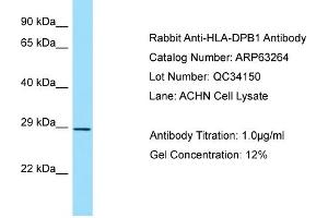 Western Blotting (WB) image for anti-Major Histocompatibility Complex, Class II, DP beta 1 (HLA-DPB1) (Middle Region) antibody (ABIN2789429) (HLA-DPB1 anticorps  (Middle Region))