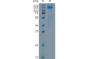 Human Protein, mFc Tag on SDS-PAGE under reducing condition.