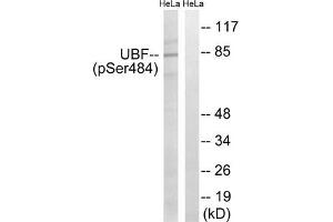 Western blot analysis of extracts from HeLa cells, treated with calyculinA (50 ng/mL, 30 mins), using UBF (Phospho-Ser484) antibody. (UBTF anticorps  (pSer484))