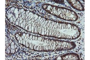 Image no. 2 for anti-Carboxypeptidase A2 (Pancreatic) (CPA2) antibody (ABIN1497598)