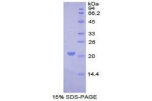 SDS-PAGE of Protein Standard from the Kit  (Highly purified E.