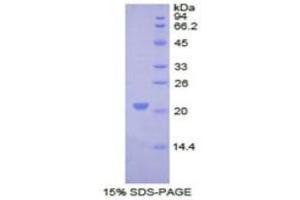 SDS-PAGE of Protein Standard from the Kit  (Highly purified E. (COL8A1 Kit ELISA)