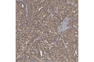 IHC analysis of mSin3A/SIN3A using anti-mSin3A/SIN3A antibody (ABIN7602504). (SIN3A anticorps  (AA 8-918))