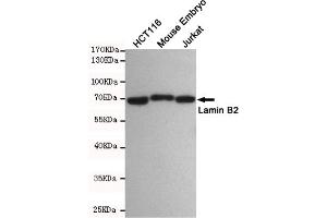 Western blot detection of Lamin B2 in HC, Mouse Embryo and Jurkat cell lysates using Lamin B2 mouse mAb(dilution 1:500). (Lamin B2 anticorps)