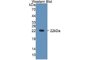 Figure. (GCDH anticorps  (AA 270-438))