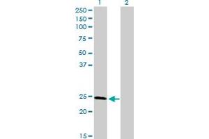 Western Blot analysis of RAD51L3 expression in transfected 293T cell line by RAD51L3 MaxPab polyclonal antibody. (RAD51D anticorps  (AA 1-216))