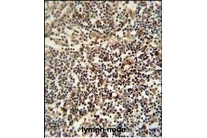 LTM5 antibody (N-term) 10077a immunohistochemistry analysis in formalin fixed and paraffin embedded human lymph node followed by peroxidase conjugation of the secondary antibody and DAB staining.