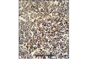LTM5 antibody (N-term) 10077a immunohistochemistry analysis in formalin fixed and paraffin embedded human lymph node followed by peroxidase conjugation of the secondary antibody and DAB staining. (LAPTM5 anticorps  (N-Term))
