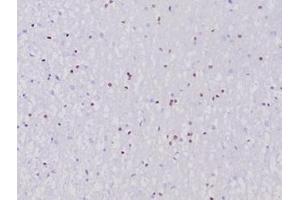 Formalin-fixed, paraffin-embedded human cerebellum stained with OLIG2 Recombinant Rabbit Monoclonal Antibody (OLIG2/6695R).